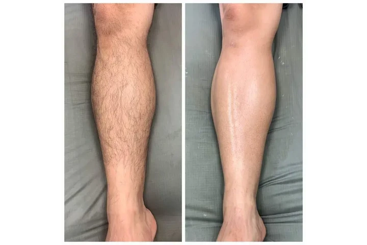 DEPILACION PARA HOMBRE/MUJER image 6