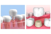 Smile Avenue Dental Group thumbnail 1