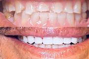 Healthy Smiles, Happy Life! thumbnail