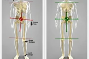 ajuste de la columna vertebral en Los Angeles