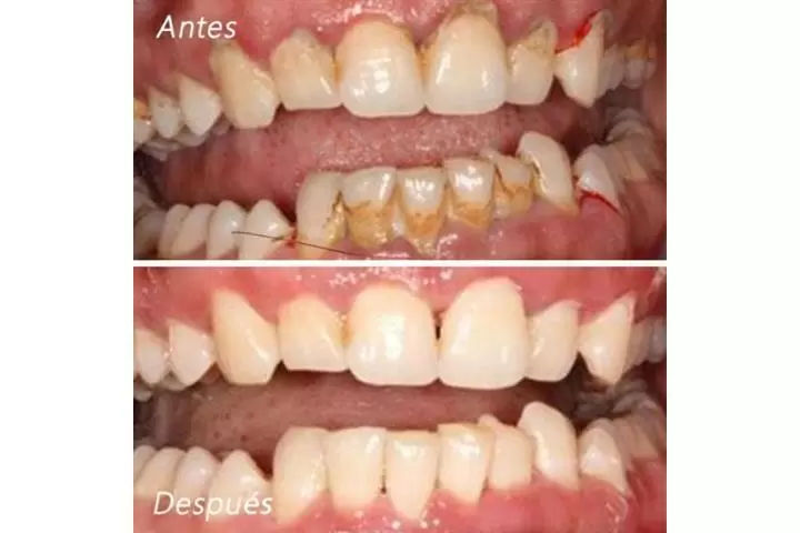 DENTISTA FAMILIAR EN VISTA image 2