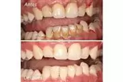 DENTISTA FAMILIAR EN VISTA thumbnail