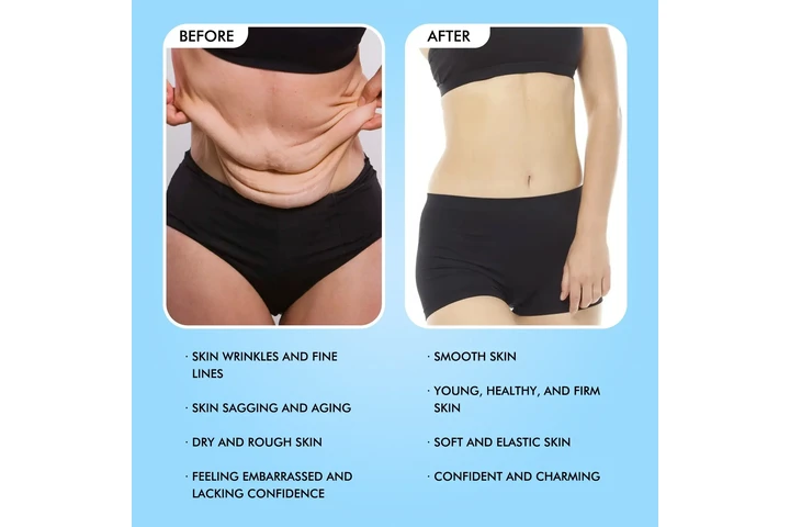 Body Firming And Anti Wrinkle image 6