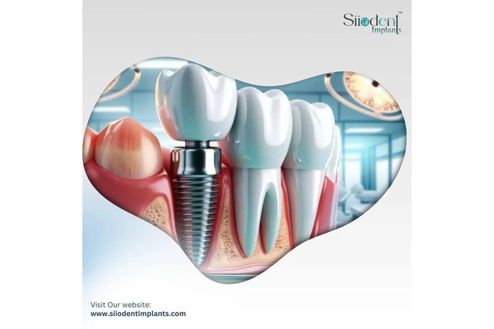 Dental Prosthetic Accessories image 1