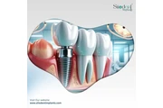 Dental Prosthetic Accessories en Orlando