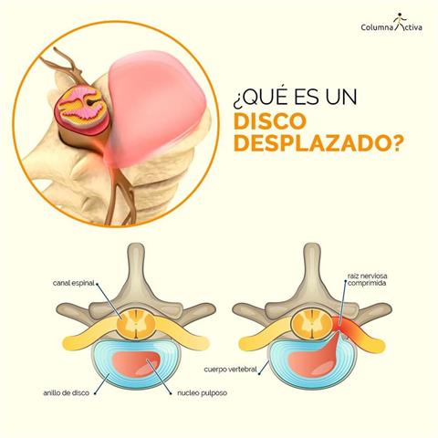 COLUMNA VERTEBRAL SOLUCIONES image 8