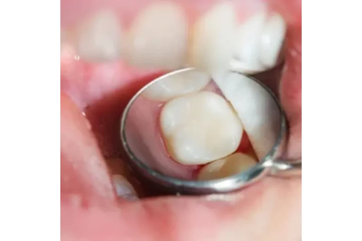 OSA Dental image 1
