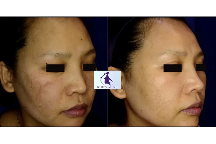 Aesthetic Treatments image 7