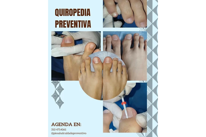 Quiropodia image 2