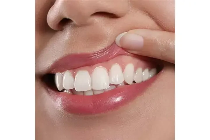 DENTISTA EN VAN NUYS image 3
