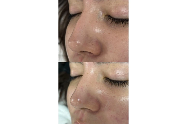 Faciales image 3
