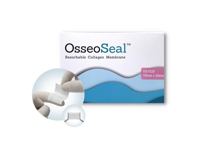 Osseoseal image 1