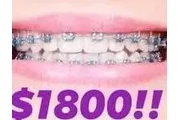 TRATAMIENTO DE BRACKETS en Morelia