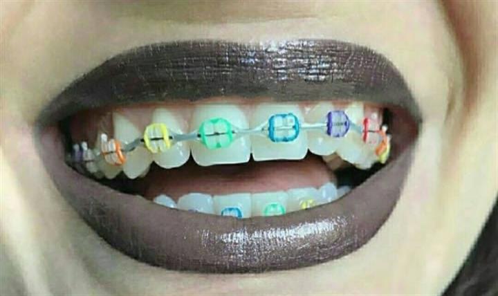 Servicio dental image 2