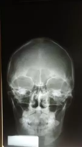 RADIOGRAFIAS A DOMICILIO image 3