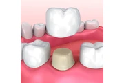 Solano Dental & Orthodontics thumbnail 4