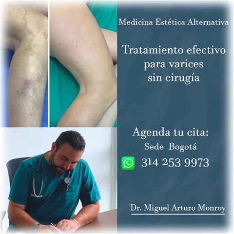 TrataVarices Dr.MiguelMonroy image 1