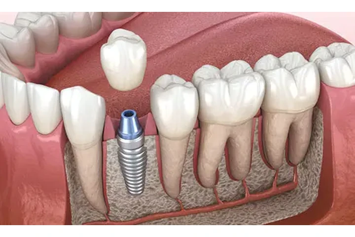 Dentista económico en Lynwood image 3