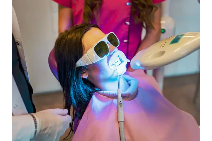 Blanqueamiento Dental $50 dls image 6