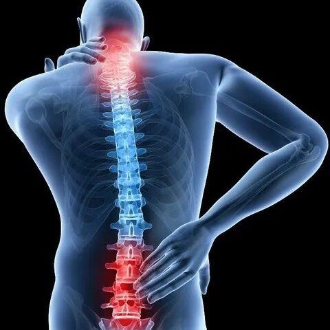 Expert Spine Pain Treatment i image 1