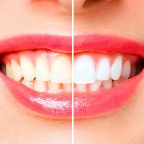 ODONTOLOGÍA COSMETICA image 7