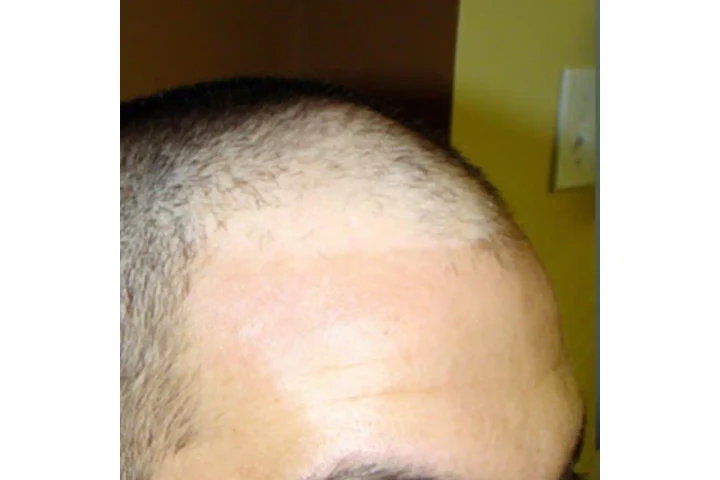 ¿ESTÁS PERDIENDO EL CABELLO? image 4