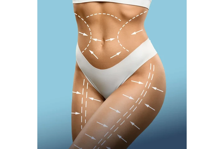 AB Body Contour Fit image 1