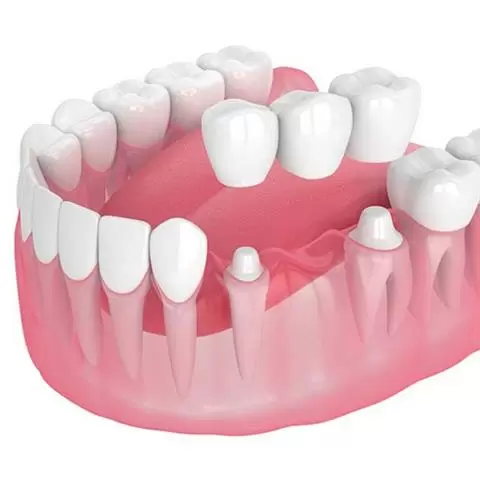 ANGEL DENTAL CARE image 3