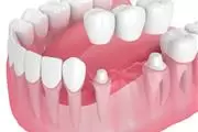 ANGEL DENTAL CARE thumbnail 3