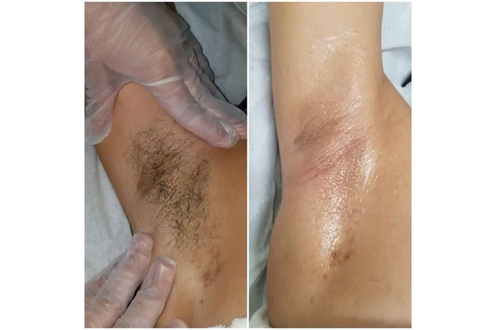 Yaki Skin Care 786 424 2635 image 6