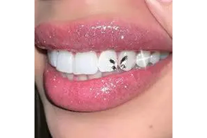Blanqueamiento Dental $50 dls image 8