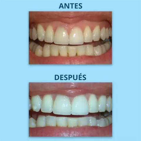 Dr. Soto The Downey Dentist image 8