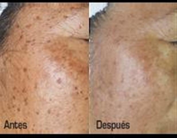 Upper Layers Skin Care image 4