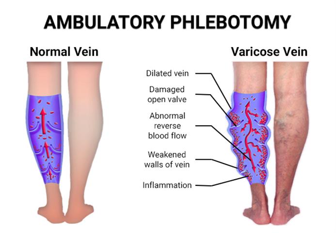 Ambulatory Phlebotomy image 2