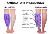 Ambulatory Phlebotomy thumbnail