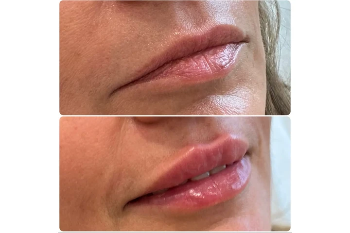 Novel U Wellness & Med Spa image 1