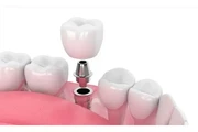 DENTISTA DE UCLA en Orange County