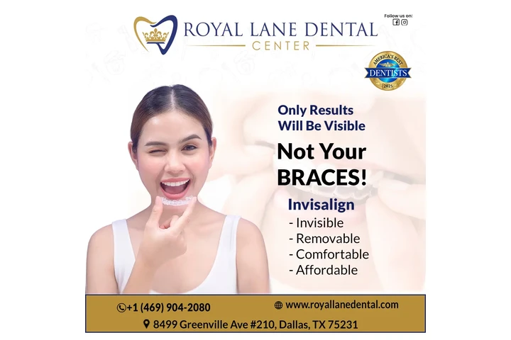 Clear Aligners in Dallas image 1