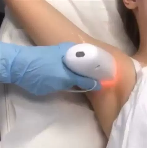 Electrolisis y Laser 12/14 image 2