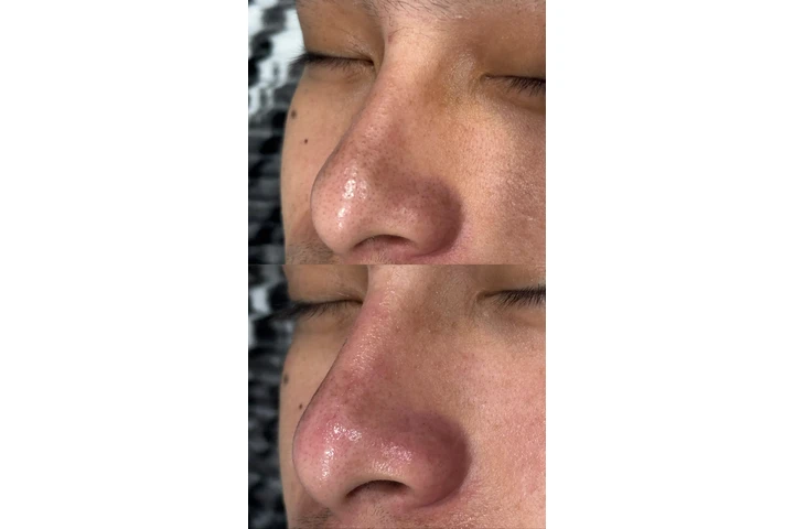 Faciales image 2