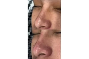 Faciales thumbnail