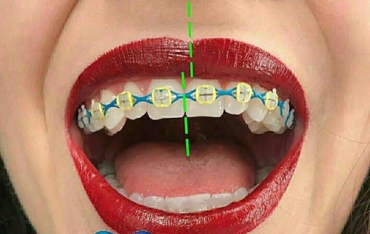 Servicio dental image 6