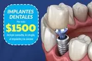 Dentista Familiar Accesible en Orange County