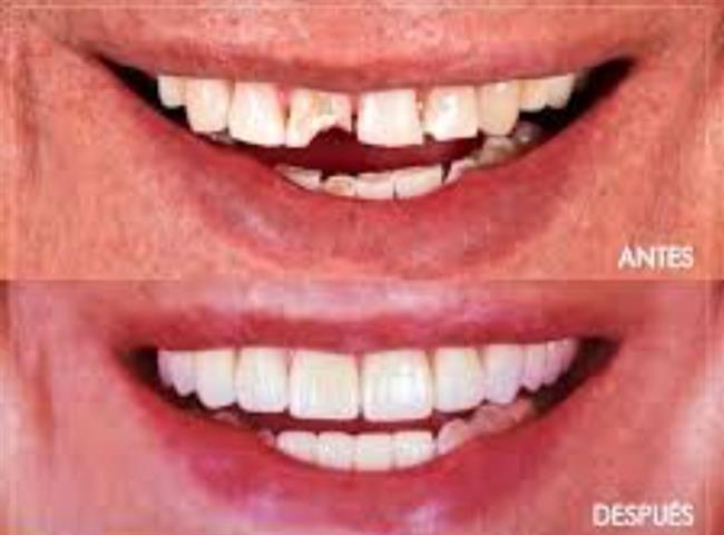 Servicio dental image 5