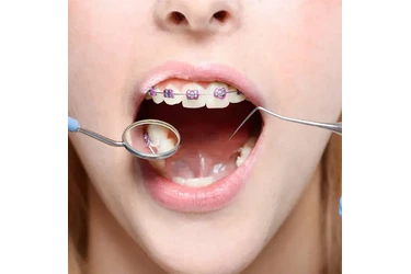 Dentista Cosmético en Orange County