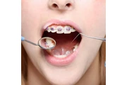 Dentista Cosmético en Orange County