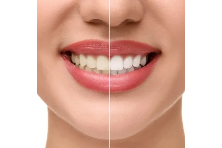 Dentista c/ precios accesibles image 6