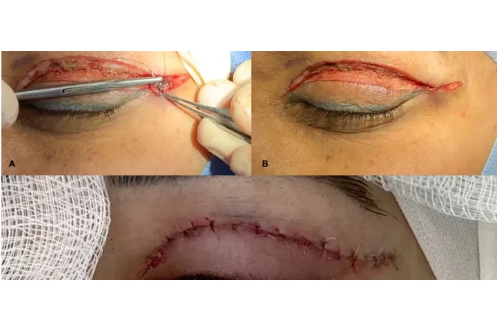 Sirugias consultas !!! image 1