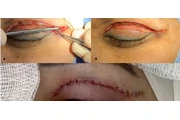 Sirugias consultas !!! en Los Angeles