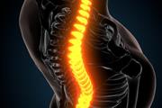 COLUMNA VERTEBRAL SOLUCIONES thumbnail